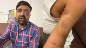 Meerut custody torture: SSP, 8 cops confronts action, ADG orders probe