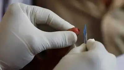 Delhi has reported 2,308 H1N1 cases so far in 2026, while cumulative: The wider industry impact