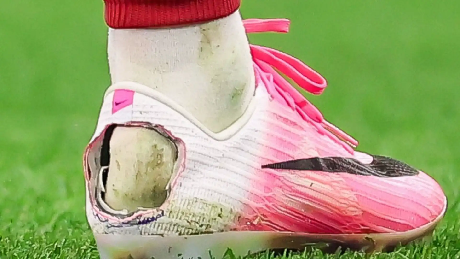 Pedro Neto was seen with a modified football foot