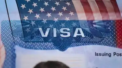 US CEO asks if US is ready to deport foreign doctors or AI engineers through the elimination