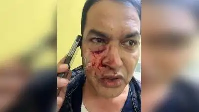 Kolkata: Former MLA Humayun Kabir , a Mamata Banerjee aide, was left with a bloodied confronts