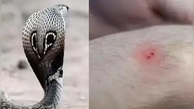 Snakebite deaths expose Tamil Nadu's rural health gaps: The wider industry impact