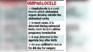 Born with his intestines protruding outside the abdominal cavity, doctors in Agartala referred