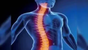 Chennai: Doctors at MGM Healthcare have used spinal cord stimulation to help a 30-year-old auto