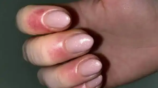 Are manicures damaging your nails? The hidden truth behind weak and brittle nails