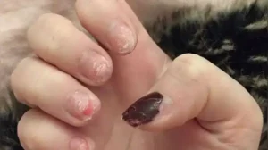 Are manicures damaging your nails? The hidden truth behind weak and brittle nails