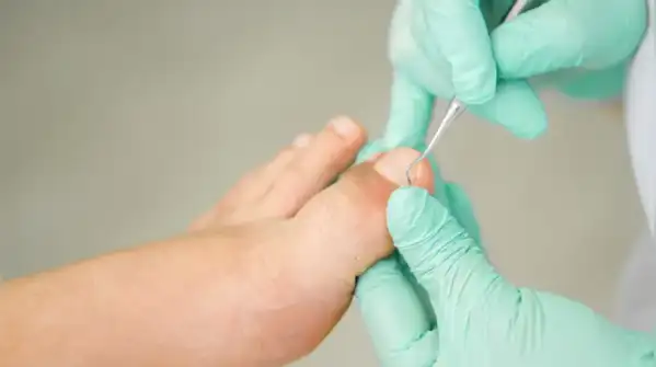 Are manicures damaging your nails? The hidden truth behind weak and brittle nails