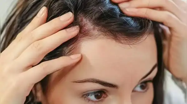 When we stop treating hair fall merely as a cosmetic inconvenience and start viewing it as