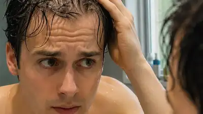 For a lot of men, the first sign of hair loss is not necessarily a bald patch