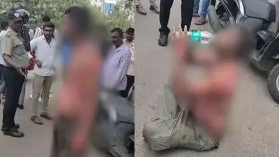 Youth immolates himself while asking diploma student to love him, attempts to hug her in Mysuru