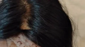 Nish Hair under fire? Woman claims Rs 35,000 wig started shedding; Parul Gulati responds