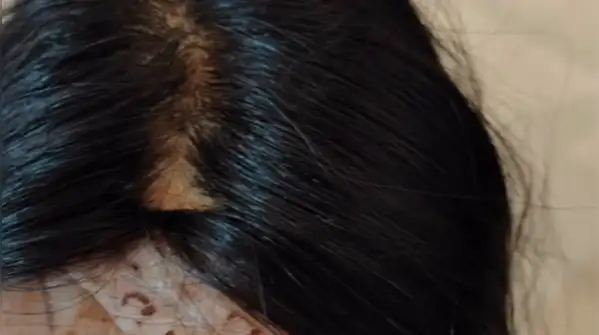 Nish Hair under fire? Woman claims Rs 35,000 wig started shedding; Parul Gulati responds