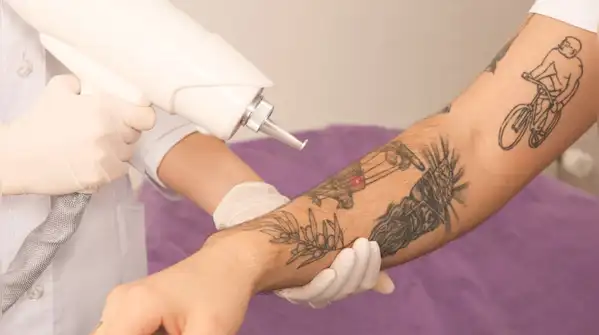 Know your own skin, look at the weather around you, and pay attention to what the tattoo is