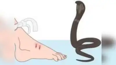 35-year-old man dies after snake bite