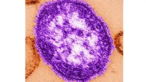 US reports 4,410 measles cases in 2026; Pennsylvania emerges as: The wider industry impact