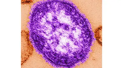 US reports 4,410 measles cases in 2026; Pennsylvania emerges as: The wider industry impact