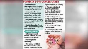 Clot From Uterine Tumour Moves To Heart, Woman Safe After Op: The wider industry impact