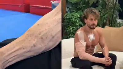 Actor Tiger Shroff 's team shared a video showing gunpowder marks on his arms on Thursday, days