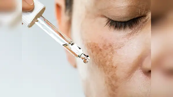 Tanning may affect the forehead, cheeks, arms or hands according to sun exposure, whereas dark