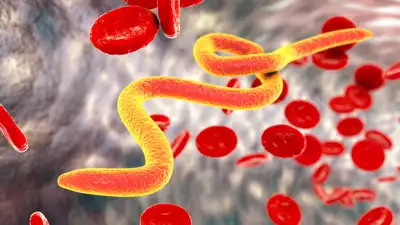 Worm infections are often regarded as a childhood health problem, but this perception can lead