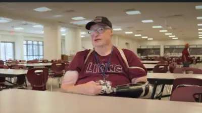 At 21, Joey Brown survived a gas explosion that left burns across 85% of his body, beginning