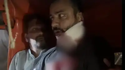 A social worker from Malwani was brutally attacked with sickles by a gang of men outside