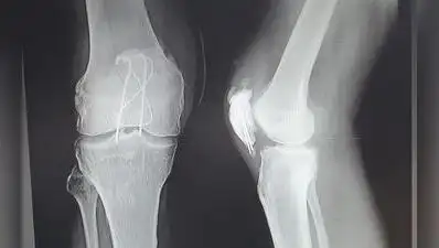 Dr Yogeesh D Kamat, consultant hip & knee surgeon at KMC Hospital: The wider industry impact