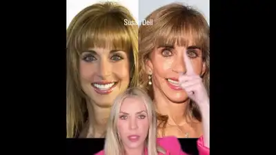 Cosmetic doctor reacts to Susan Dell's before-and-after photos